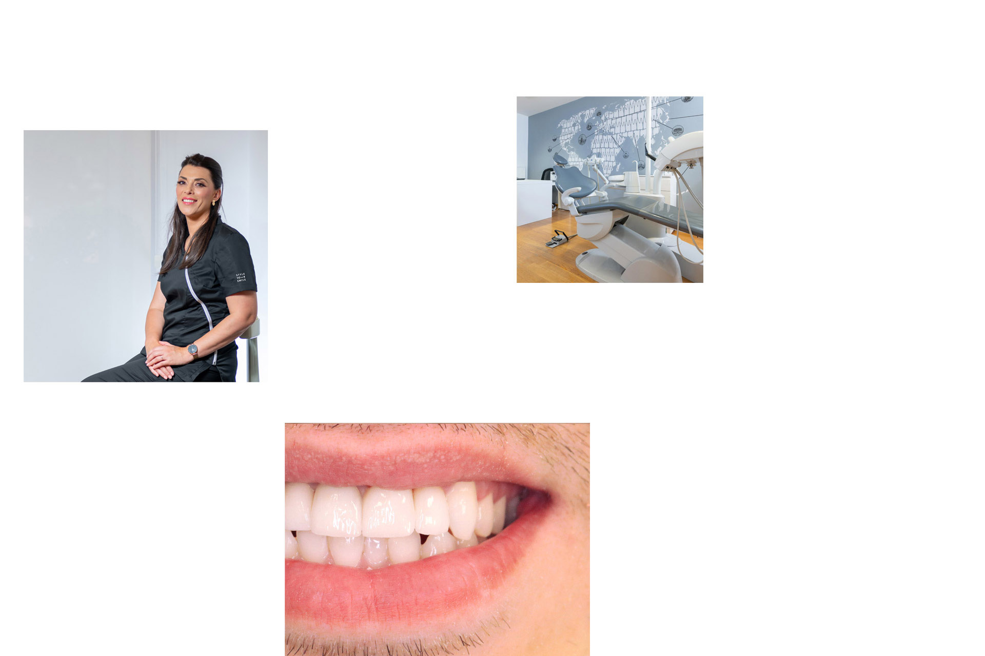 Smile makeover by Style Your Smile - dr. Marija Stantić Boras